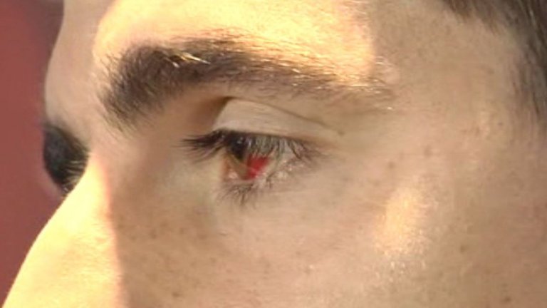 Thibaut Courtois
